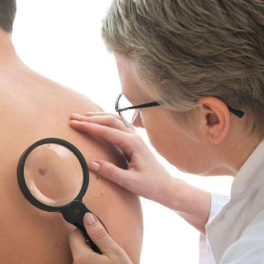 skin checks